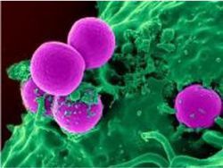 Больницы США являются рассадниками для микробов