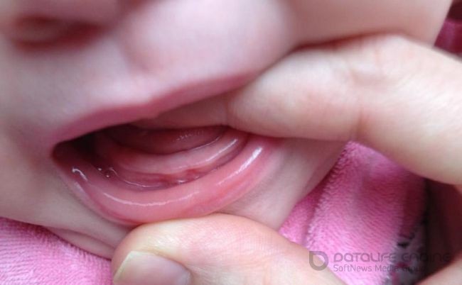 Как успокоить ребенка, когда у него появляются зубы?