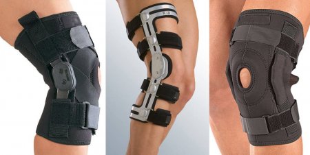 Чем фиксируют колено при травмах? - «Я и Здоровье»
