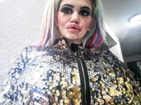 Как выглядит 22-летняя женщина, которая увеличила свой рот в 4 раза - «Я и Красота»