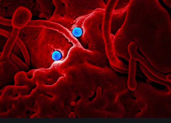 Создан тест, способный моментально выявлять коронавирус в организме - «Новости»