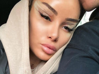 Айза Анохина сделала подтяжку лица - «Я как Звезда»