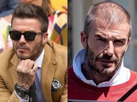 Дэвид Бекхэм стремительно лысеет - «Я как Звезда»