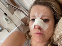 Ксения Собчак рассказала о перенесенной операции - «Я как Звезда»