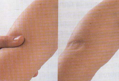 Если отекают ноги - «Разное»