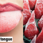 Ученые узнали, как кишечная нервная система в кишечнике взаимодействует с мозгом - «Новости медицины»