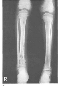 Загадочная болезнь превратила пятерых членов семьи из Доминиканы в «инопланетян» - «Новости медицины»